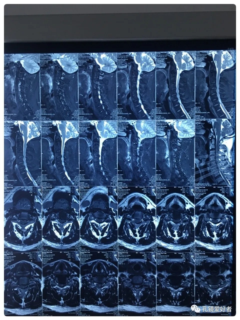 圖片關(guān)鍵詞